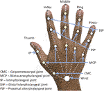 Single Shot Corrective CNN for Anatomically Correct 3D Hand Pose Estimation